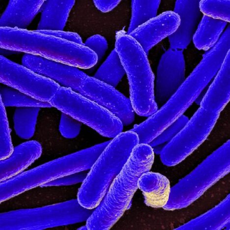 Connection Found Between Household Chemicals and Gut Microbiome